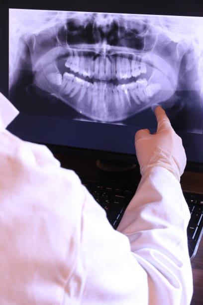 Best Emergency Tooth Extraction in North Miami, FL